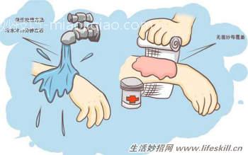 如何处理烫伤后起的水泡?